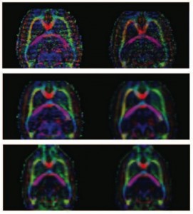 Improvement in FA color maps from our method, axial view of one slice. Rows from top to bottom: resolutions of 0:2mm3, 0:3mm3 and 0:4mm3. Left column: original acquisitions with the best CNR in each of the resolutions. Right col: Averaged subject with improved CNR.